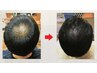 【髪の毛のボリュームが気になる方必見☆】ヒト幹細胞強髪ヘッドスパ￥7500