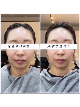 ニコット(Nicotto) ヘッドスパ