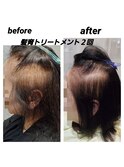 髪育トリートメント×２回　before　after