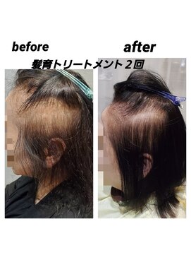 髪質改善 ソアリス 烏丸丸太町店(soiris) 髪育トリートメント×２回　before　after