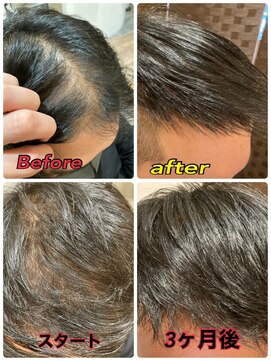 ユーリカ リチェルコ 四天王寺前夕陽ケ丘店 本格育毛促進 男性