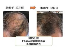 様々な機関で立証された高い技術で頭髪のお悩みを解決致します