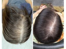 カームバイリコ 学芸大学(calm by liko)の雰囲気（男女問わず効果【高濃度ヒト幹細胞による頭皮ケア育毛促進】）
