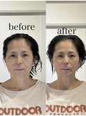 骨格補正ヘッドスパ・小顔矯正