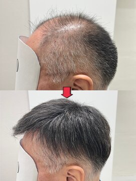 ラソヘアー(Lazo hair) かつら