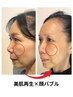 【美肌促進・女性専用】ヒト臍帯幹細胞上清液100%使用！￥44000→￥27500