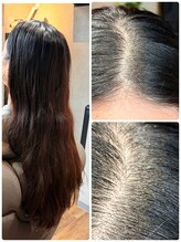 【カウンセリング】髪と頭皮の状態チェック《頭皮ケアやエイジングケアをご検討の方へ》