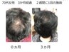 育毛を促進スタンダードケアコース