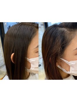 ピン！とならない自然で柔らかな仕上がりが好評♪一人一人のクセ毛に合わせた数種類の薬剤で理想の美髪に！