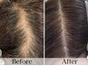 【育毛を促進&細毛改善】頭皮改善エステ/細毛を最短で解決へ導く特別メニュー