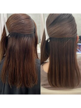 シンズ 銀座(sins) 気になるコンプレックスをsinsストレートで解消[30代40代50代]