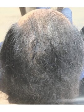 増毛エクステ専門店 エクステルーム 渋谷店(exteroom) エアエク増毛エクステ★600本！トップのボリュームUP