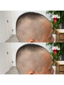 リンク(LINK) feather back