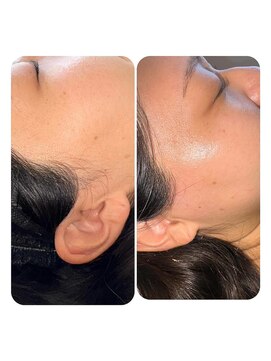 アルコ(ALCO) 艶肌フェイスワックス【全顔】