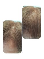 ユーフォルムギンザ(y-Forme Ginza)&nbsp;話題のトキカタ♪前髪編