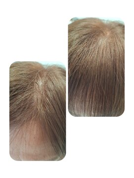 ユーフォルムギンザ(y-Forme Ginza) 話題のトキカタ♪前髪編