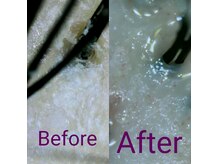 ボーテシェルメール(Beaute Chere Mere)の雰囲気（韓国式×日本に合わせたサロン独自頭皮洗浄ヘッドスパ全15工程★）