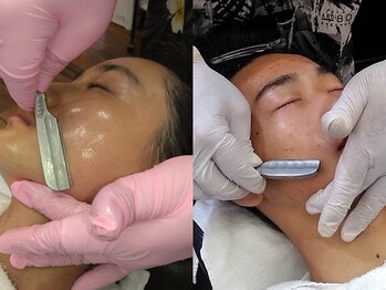 ハール(Haar)の写真/【40,50代 フェイシャルシェービング】メンズだけでなくレディースシェービングも！顔剃りエステで美しく☆