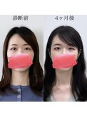 ビフォーアフター