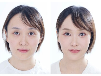 アガールの写真