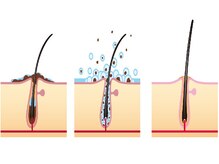 様々なお悩みに対応出来る、豊富なラインナップをご紹介！！