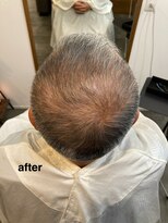 テール(TERRE) 【毛の立ち上がりが変わる】メンズの頭皮骨格調整カット