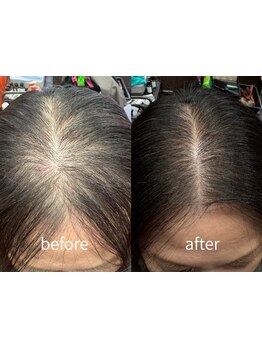 髪の悩みを解決してくれるマンツーマンサロン☆男女問わず人気のヘッドスパで癒しのひと時をご提供します♪