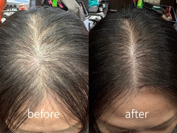 ハーティー(Hearty)の写真/髪の悩みを解決してくれるマンツーマンサロン☆男女問わず人気のヘッドスパで癒しのひと時をご提供します♪