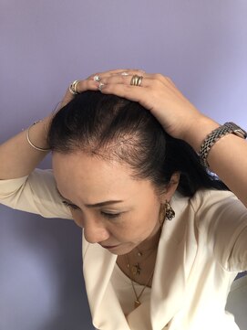 グレースフィオーレ 苫小牧店 グレースグロウセラピー