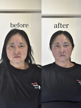 ヘアホスピタル ファニーフェイス(HAIR HOSPITAL funny face) 骨格補正ヘッドスパ・小顔矯正/暗めカラー