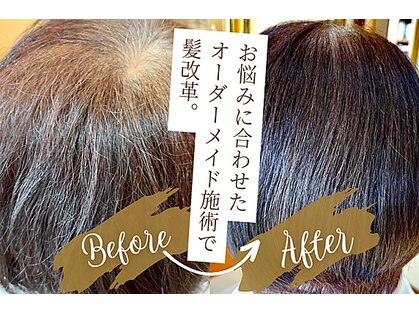ハッチヘアー(Hacchi hair)の写真