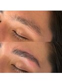 HOLLYWOOD BROW LIFT