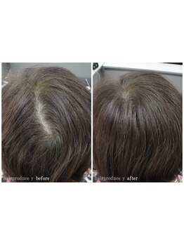 【板宿駅徒歩2分】特許取得の「エクステ」◆トップのボリュームを創り、お悩みを解決に導きます！