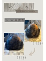 アヴェリーノ 中目黒(Avellino) 3000本装着~メンズ~