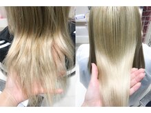 実際に施術されたお客様 No.2