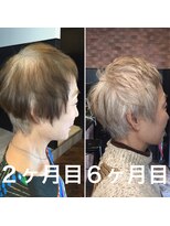 バイナル 白髪にしようかお悩みの方へ　金子