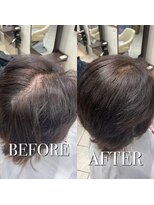 コレットヘア(Colette hair)&nbsp;ヘアリセッター　髪質改善　つむじの割れ　ボリュームUP