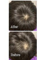 なご美ヘアー(なご美hair)&nbsp;つむじカバー増毛