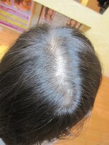 ヨシユキコンディショニング&nbsp;Before つむじ補正ー７