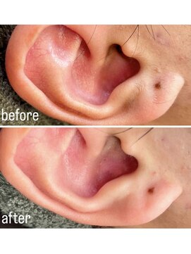 テラス(Terrace) シェービング