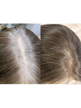 《榴ヶ岡》大人でもできる自然でナチュラルな白髪染め、白髪ぼかし、パーソナルなカラーを。