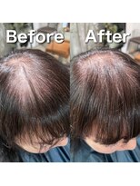 ツムグ 代官山 中目黒(TUMUGU)&nbsp;前髪割れ・地肌見え解消/ボリュームアップエクステ