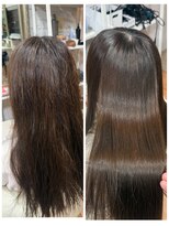 ボクノ つくば桜店(bokuno)&nbsp;mana矯正before after