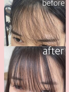 ミュー(miyuu) 前髪チューニング