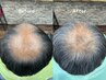 お試しクーポン【10年前の強い髪に！】強髪プログラム/育毛促進