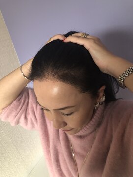 グレースフィオーレ 苫小牧店 グレースグロウセラピー