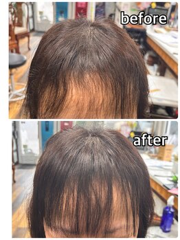 エミ(EMI)の写真/【特許増毛会員店】接着剤を使用しない増毛エクステの新技術をご体験可能です◎前髪・つむじ周りをカバー♪