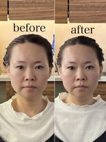 ヘアホスピタル ファニーフェイス(HAIR HOSPITAL funny face)&nbsp;骨格補正ヘッドスパ・小顔矯正/暗めカラー倉敷岡山