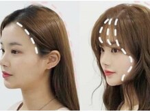 ミラクル 美容室(miracle)の雰囲気（顔まわりの似合わせ小顔カットも得意です♪【新大久保駅/韓国】）