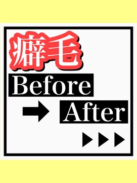 アールヘアー(ar hair) 【AR HAIR店長　白井孝文】癖毛Before、After